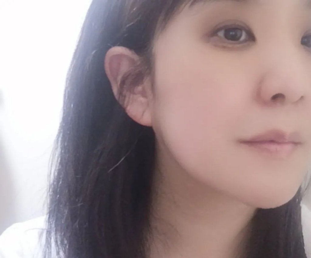 アルファラディアンスグローセラム/BANOBAGI/美容液を使ったクチコミ(8枚目)