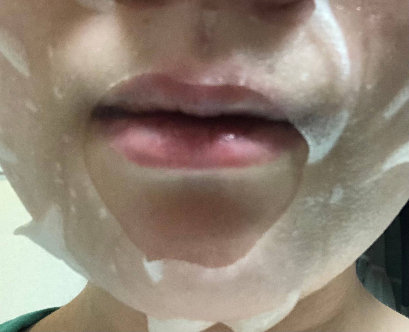 ダーマレーザー ナイアシンアミド+レチノール/クオリティファースト/シートマスク・パックを使ったクチコミ(5枚目)