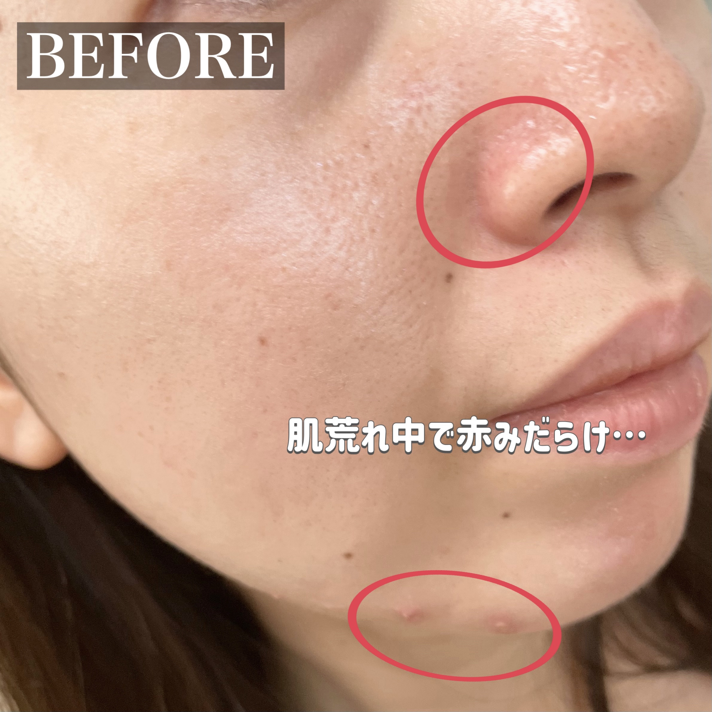 キル カバー ファンウェア コンシール パレット 02 DELIGHT/CLIO/パレットコンシーラーを使ったクチコミ（3枚目）