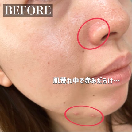 キル カバー ファンウェア コンシール パレット 02 DELIGHT/CLIO/パレットコンシーラーを使ったクチコミ(3枚目)