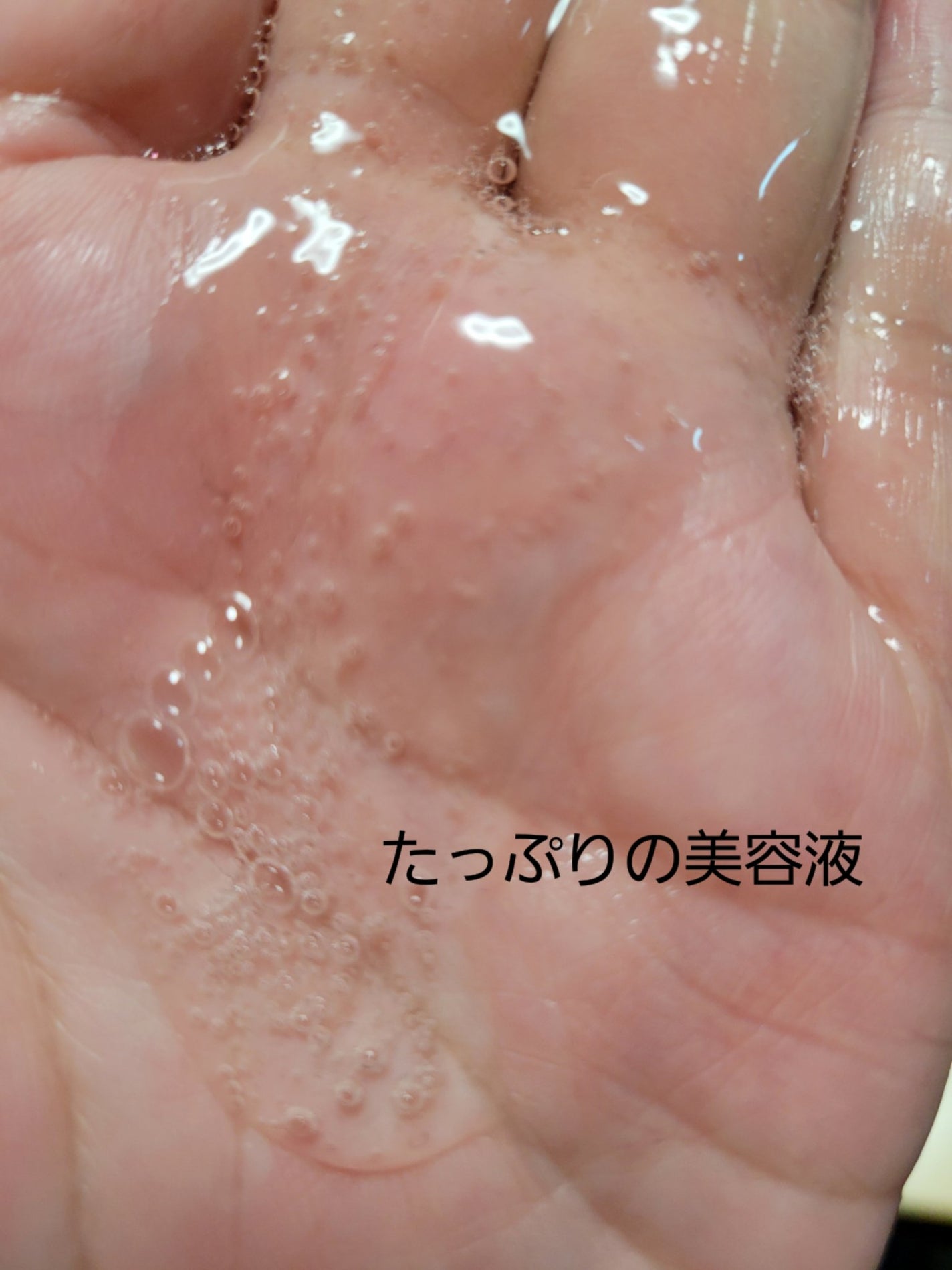 オルフェス ピュアブラック/ALFACE+/シートマスク・パックを使ったクチコミ(2枚目)