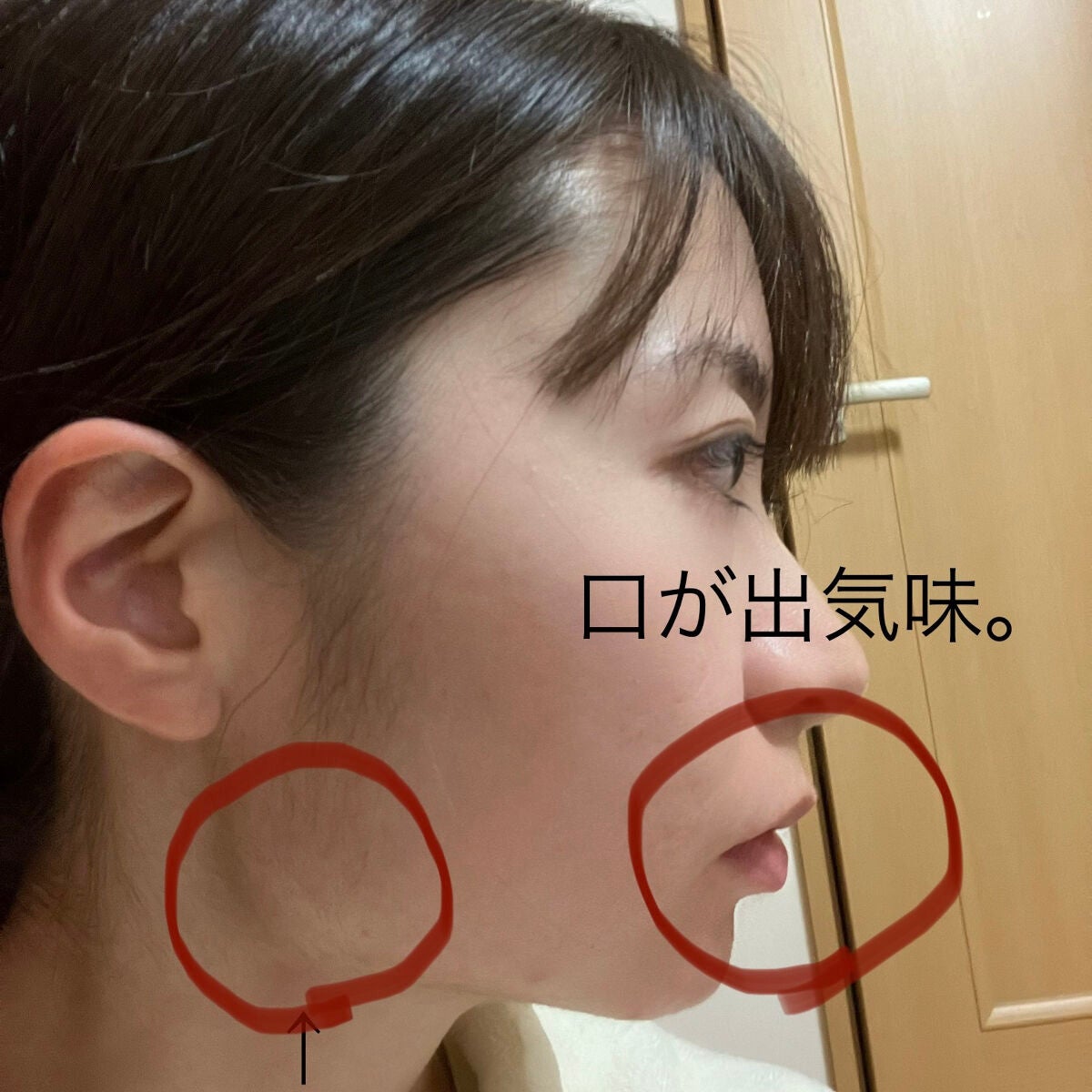 m☕️ on LIPS 「👅今日から「あいうべ体操」毎日始めます!・なぜ?→エラ張りに長..」(3枚目)