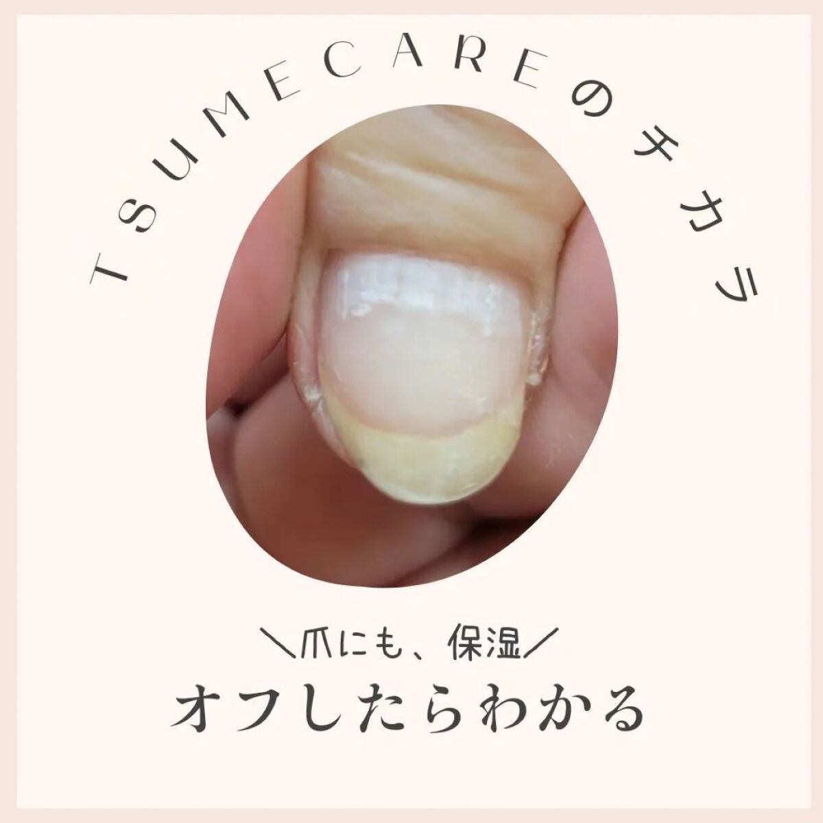 TSUMECARE/NailSalon mayunail/ネイルオイル・トリートメントを使ったクチコミ（1枚目）