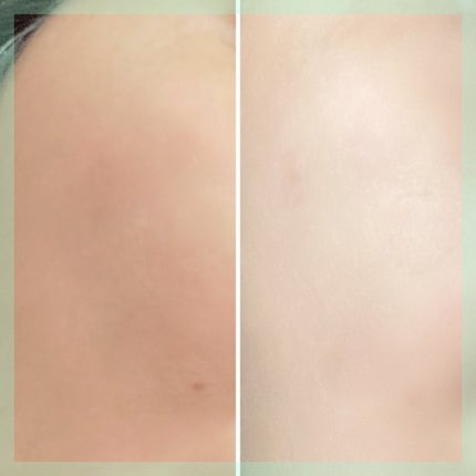 リードルショット300/VT/美容液を使ったクチコミ(5枚目)