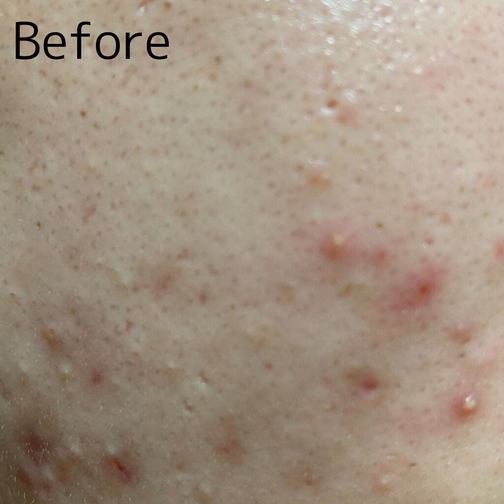 メイク落とし パーフェクトオイル/ビオレ/オイルクレンジングを使ったクチコミ(2枚目)