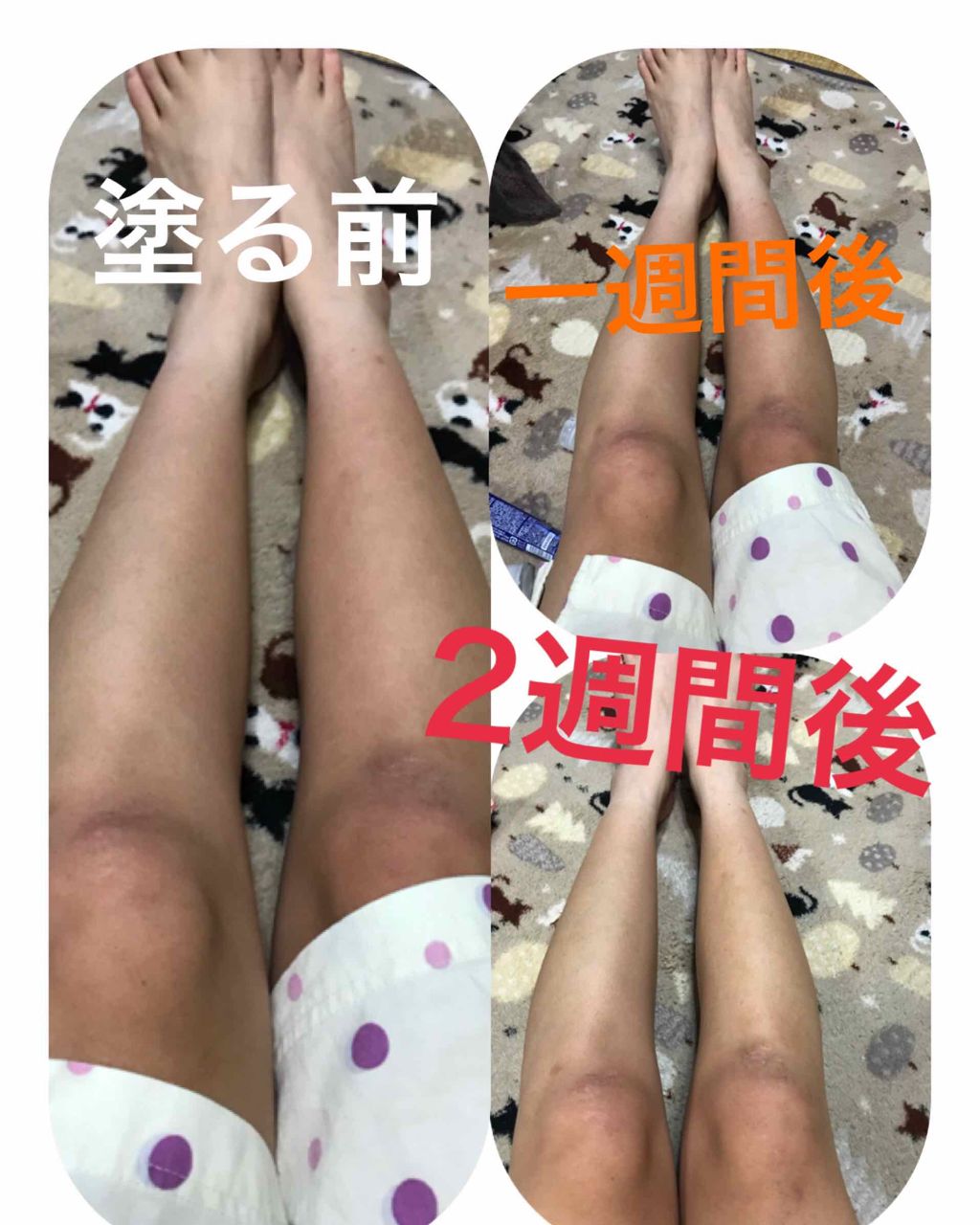 薬用美白 美容液/DAISO/美容液を使ったクチコミ（2枚目）