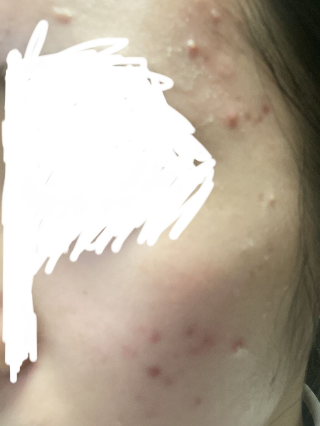 グリーン ダーマCICAビックトナー/ネイチャーリパブリック/化粧水を使ったクチコミ（2枚目）