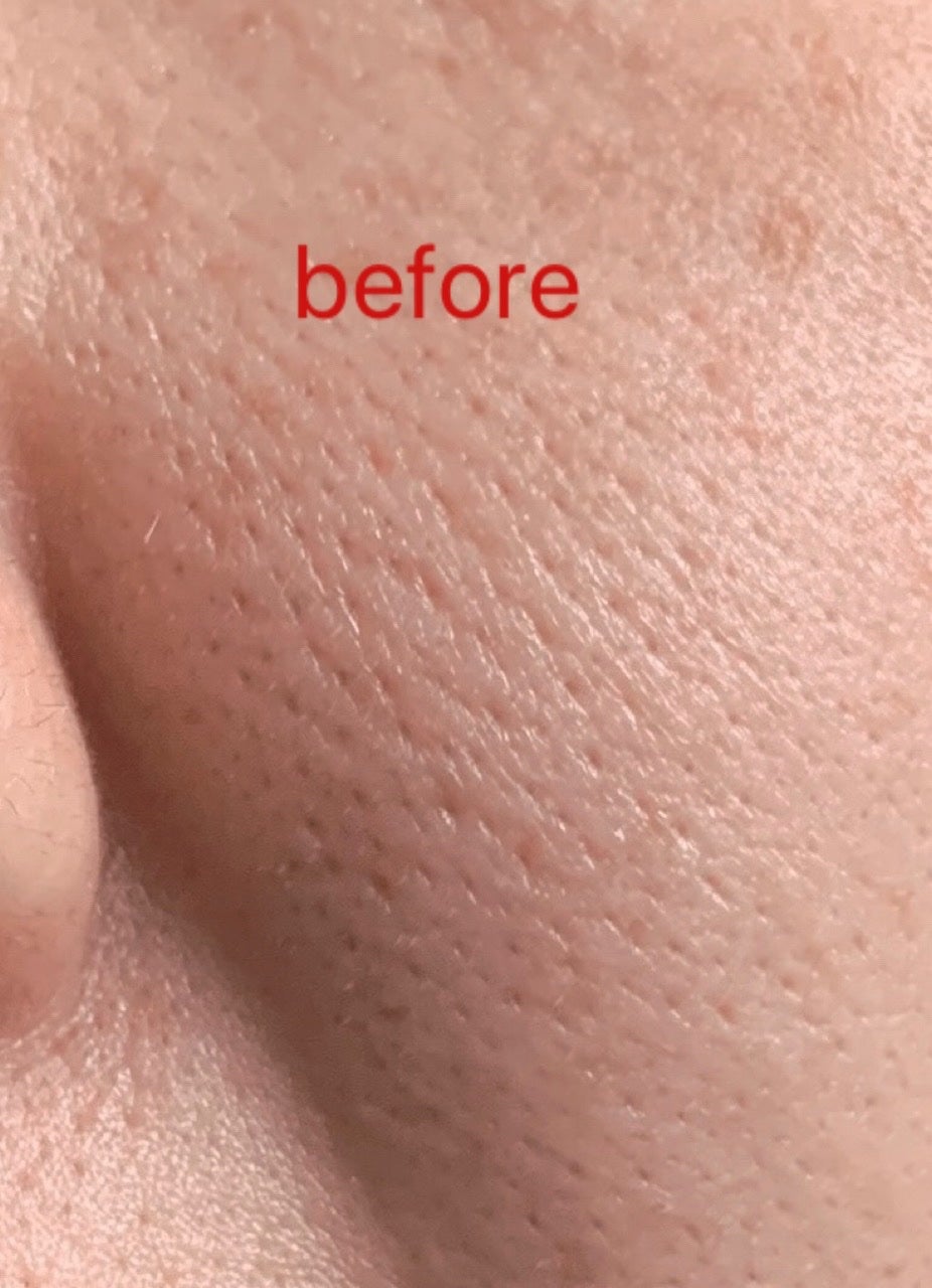 リードルショット300/VT/美容液を使ったクチコミ(6枚目)