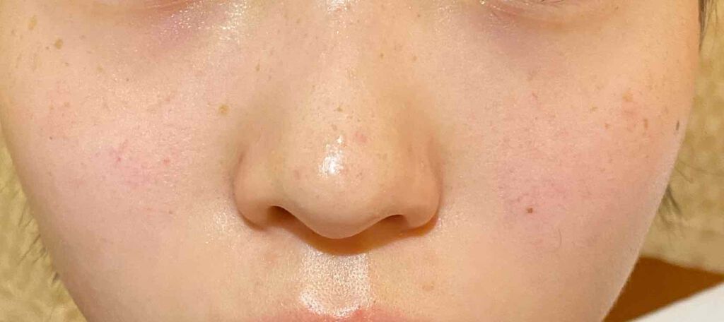 なさ on LIPS 「肌改善計画20日目こんばんは😳なさです😆💞ソフトバンクホークス..」(4枚目)