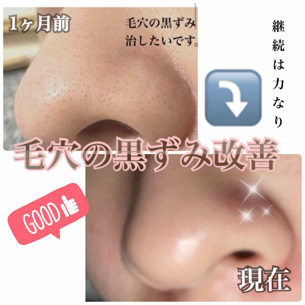 ディープピュア洗顔料/ダヴ/洗顔フォームを使ったクチコミ(1枚目)