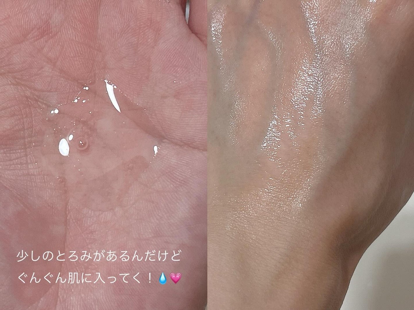 ザファーストペプチドブースティングセラム/ネイチャーリパブリック/ブースター・導入液を使ったクチコミ(5枚目)