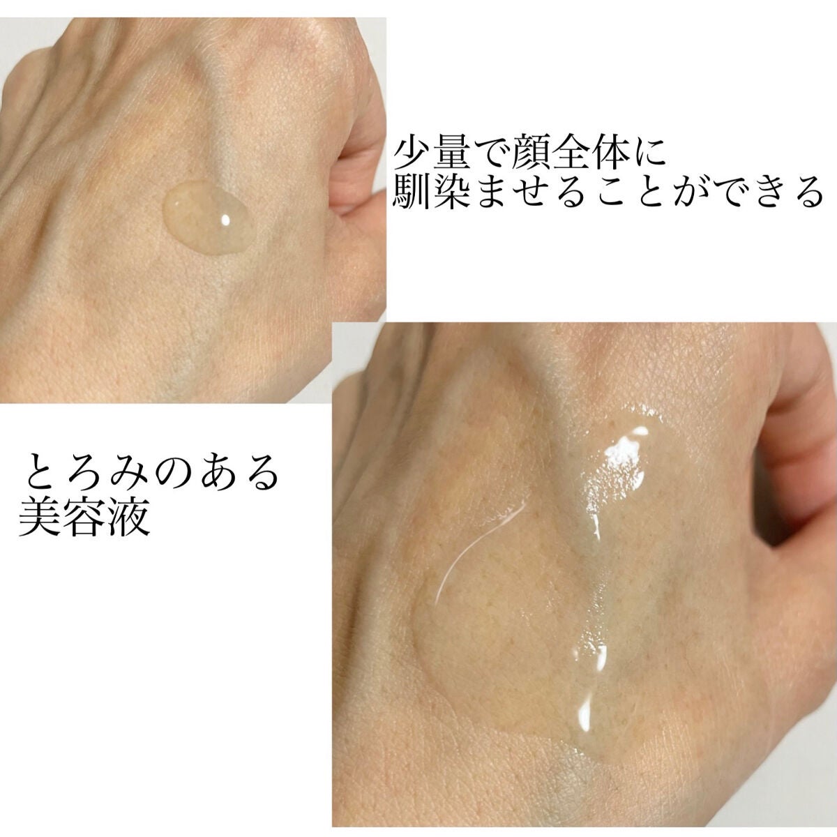 BP-PORE AMPOULE /Dr.Melaxin/美容液を使ったクチコミ(3枚目)