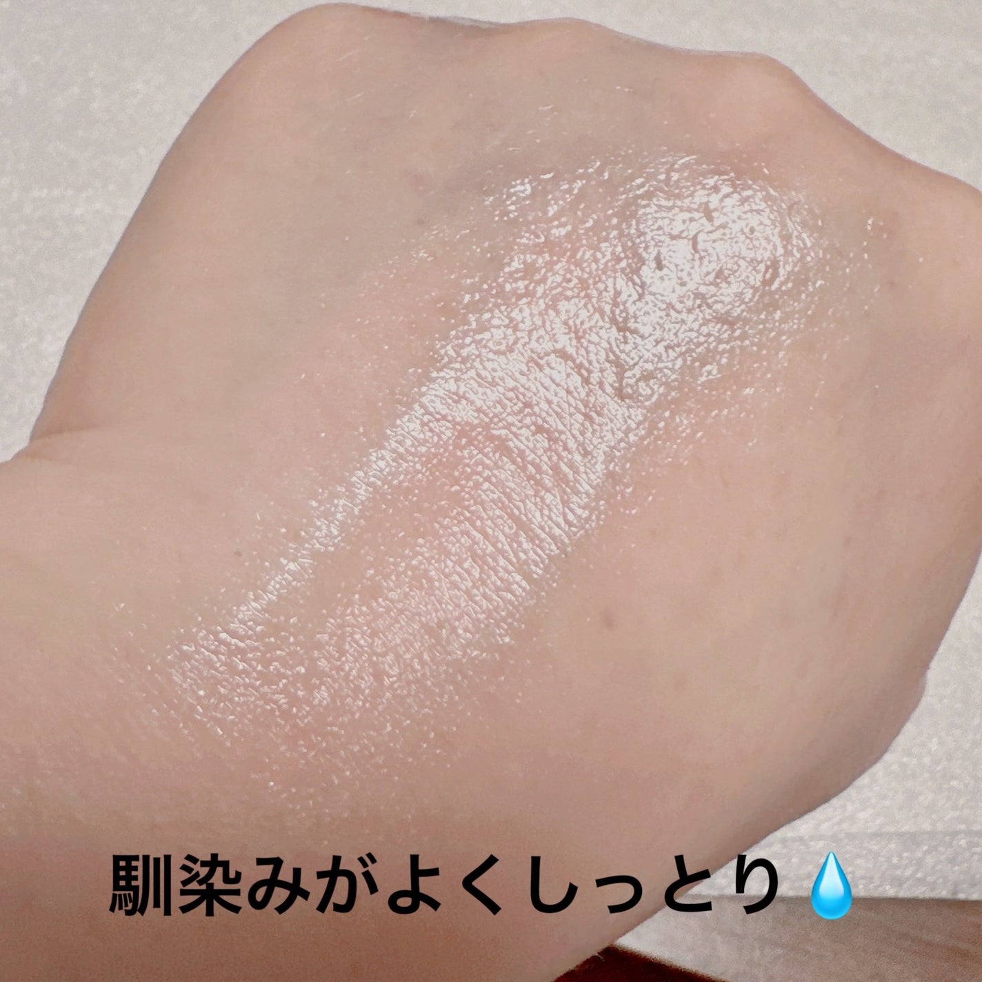 ダーマレーザースペクター ウルセラCMAX/クオリティファースト/美容液を使ったクチコミ(5枚目)