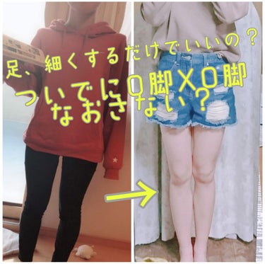 ダイエットに引き続いて今回は脚の形についてです！

いくら脚が細くてもO脚やXO脚だとショートパンツやスキニーを履いた時にちょっと「ん？」ってなりません？

ちなみに私はXO脚でした

なので今回は脚の