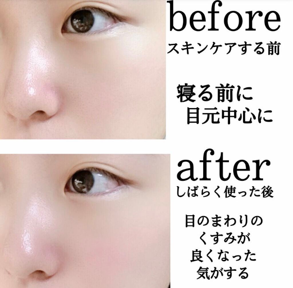 ハイドロナイト/ブレーンコスモス/フェイスクリームを使ったクチコミ(4枚目)