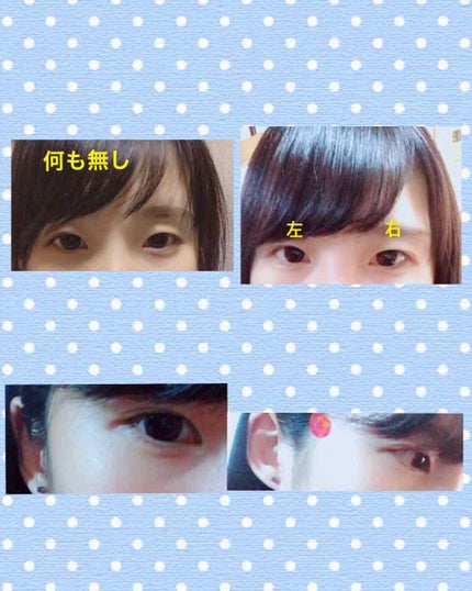 のびーるアイテープ(絆創膏タイプ、レギュラー)/DAISO/二重まぶた用アイテムを使ったクチコミ(2枚目)