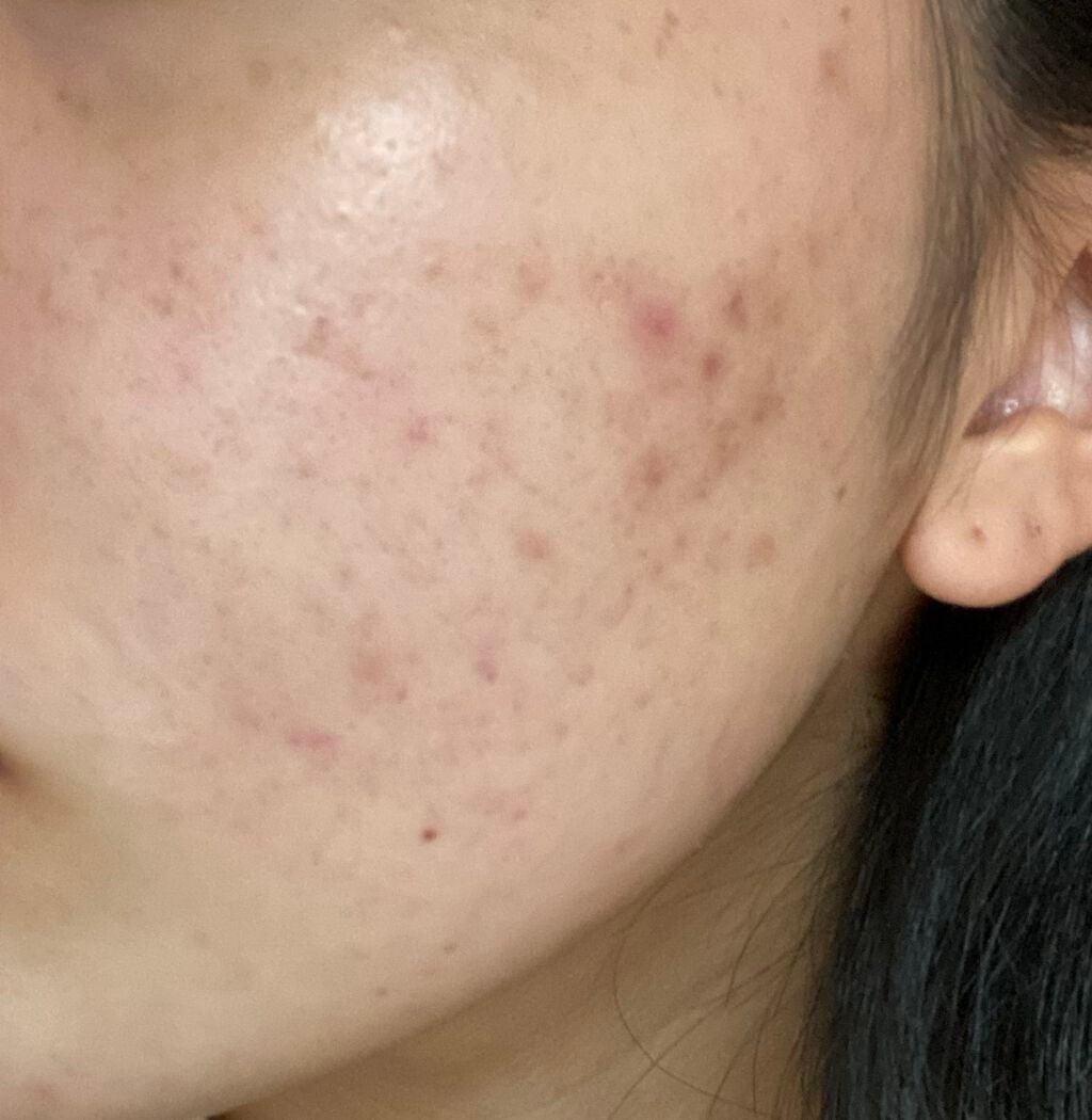 なっちゃん on LIPS 「デュアックの女でーす全然投稿してなかったー💦最近は全然デュアッ..」(2枚目)