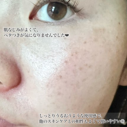 1stエクソソーム エクストラ3%セラム/GLOW@DAWN/美容液を使ったクチコミ(4枚目)