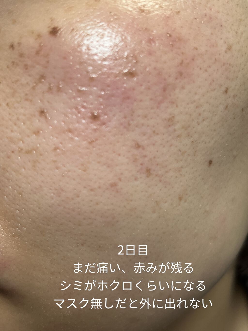 を使ったクチコミ（3枚目）