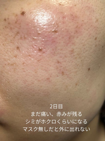 を使ったクチコミ(3枚目)