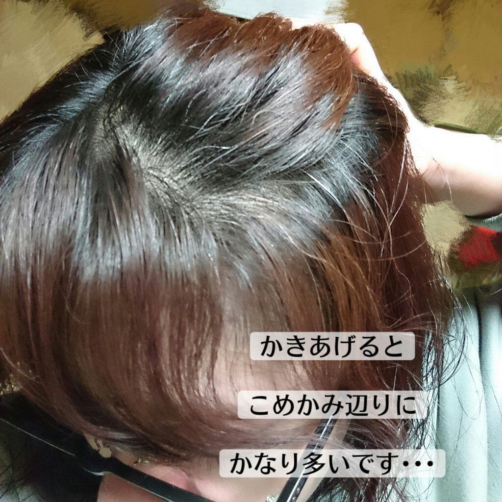 ウエラトーン ツープラスワン クリームタイプ/ウエラ/ヘアカラーを使ったクチコミ（2枚目）