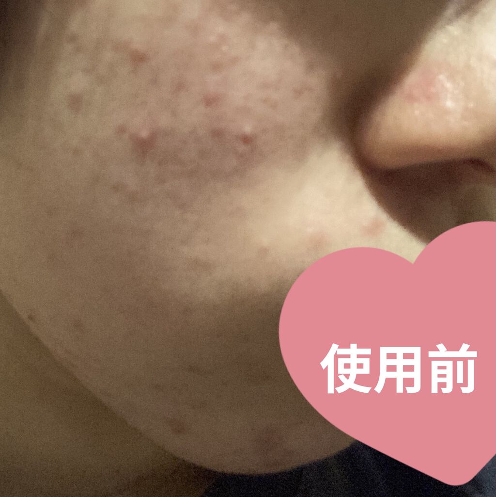 クリアトライアルセット M（しっとりタイプ）/オルビス/トライアルキットを使ったクチコミ（2枚目）