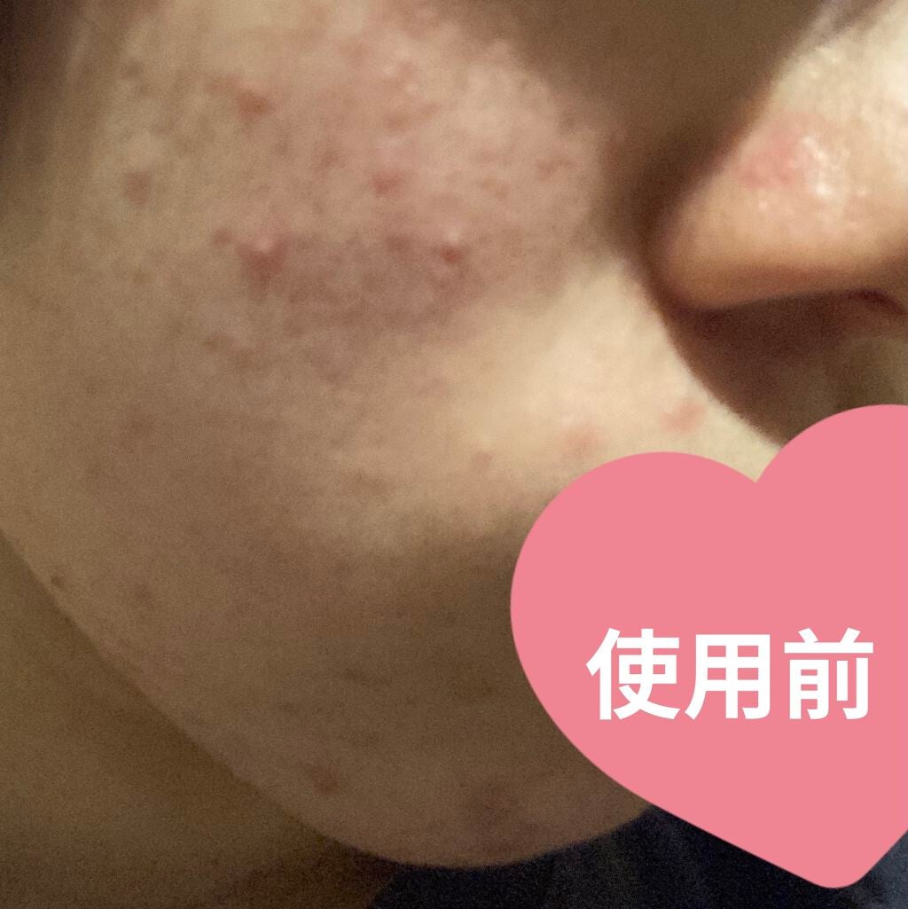 クリアトライアルセット M(しっとりタイプ)/オルビス/トライアルキットを使ったクチコミ(2枚目)