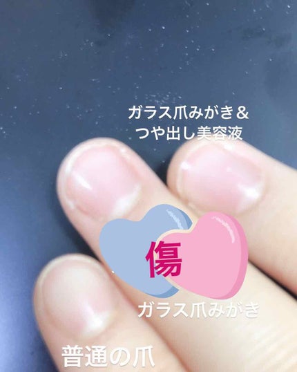 エテュセ クイックケアコート/ettusais/ネイルオイル・トリートメントを使ったクチコミ(4枚目)