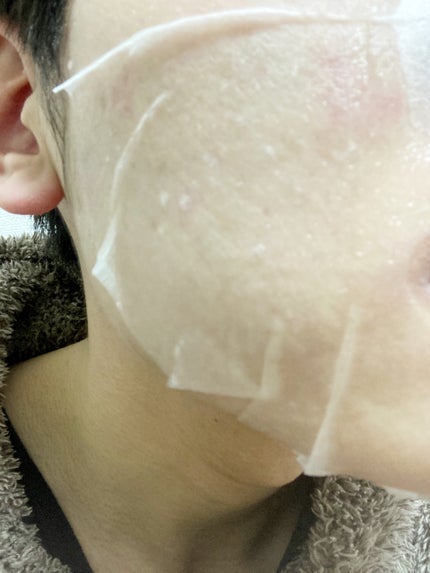 ドクタージー ピュア ビタミンB モイスチャライジングマスク/Dr.G/シートマスク・パックを使ったクチコミ(2枚目)