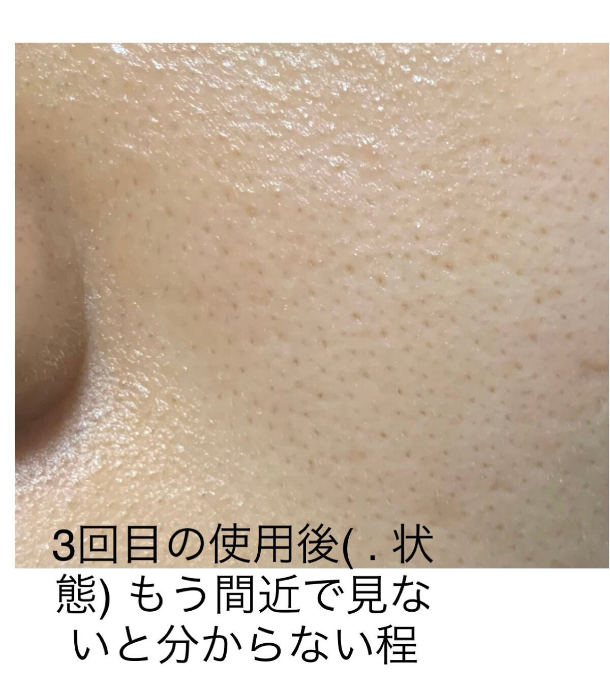 RXザ・ビタミンC23セラム/COSRX/美容液を使ったクチコミ(5枚目)