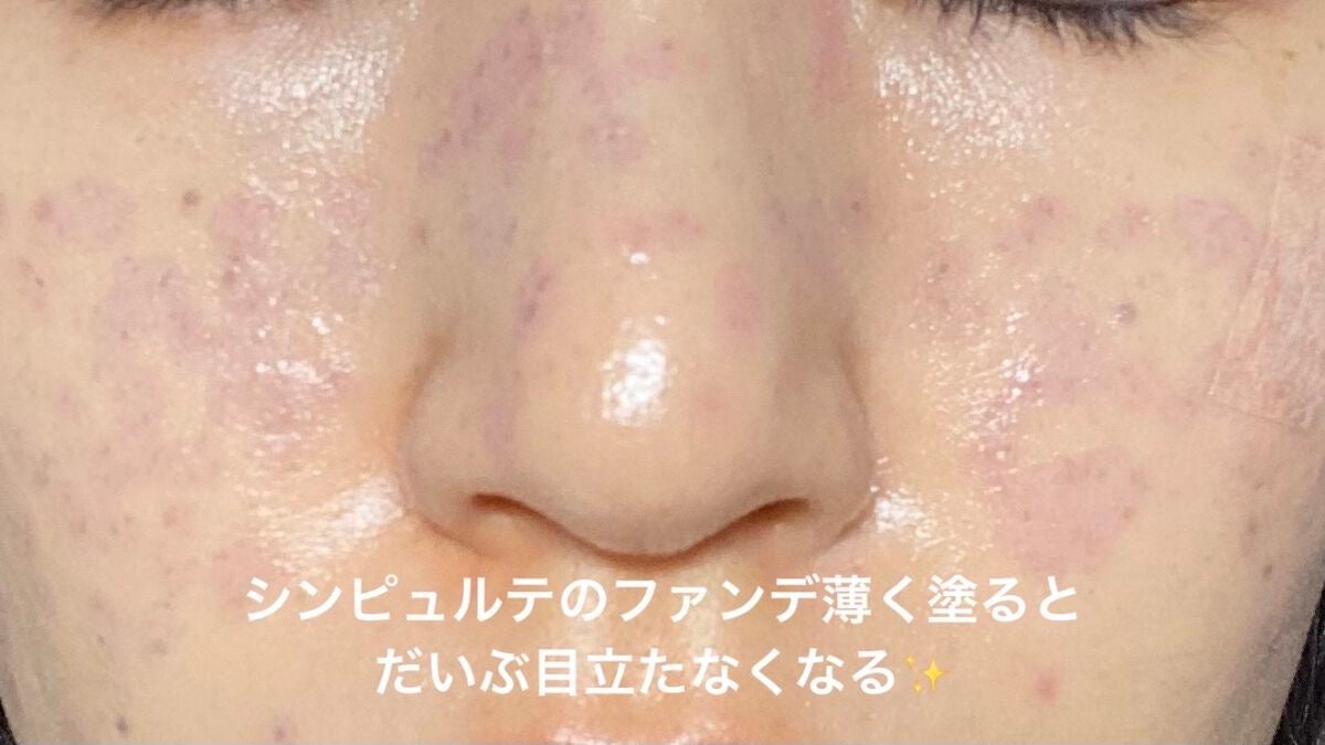 ダイブイン セラム/Torriden/美容液を使ったクチコミ(5枚目)