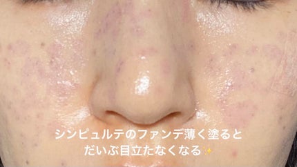 ダイブイン セラム/Torriden/美容液を使ったクチコミ(5枚目)