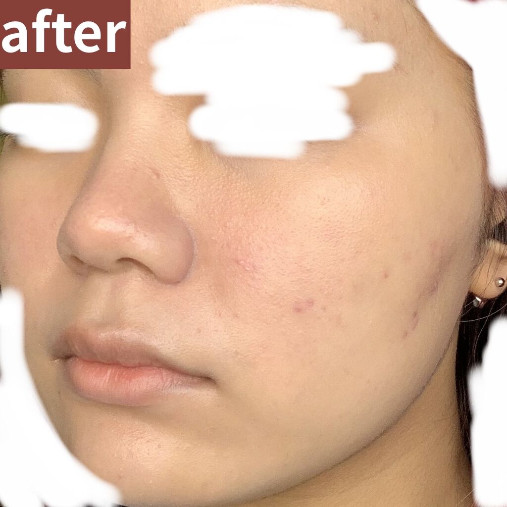 UVイデア XL プロテクショントーンアップ/ラ ロッシュ ポゼ/日焼け止めクリームを使ったクチコミ（3枚目）