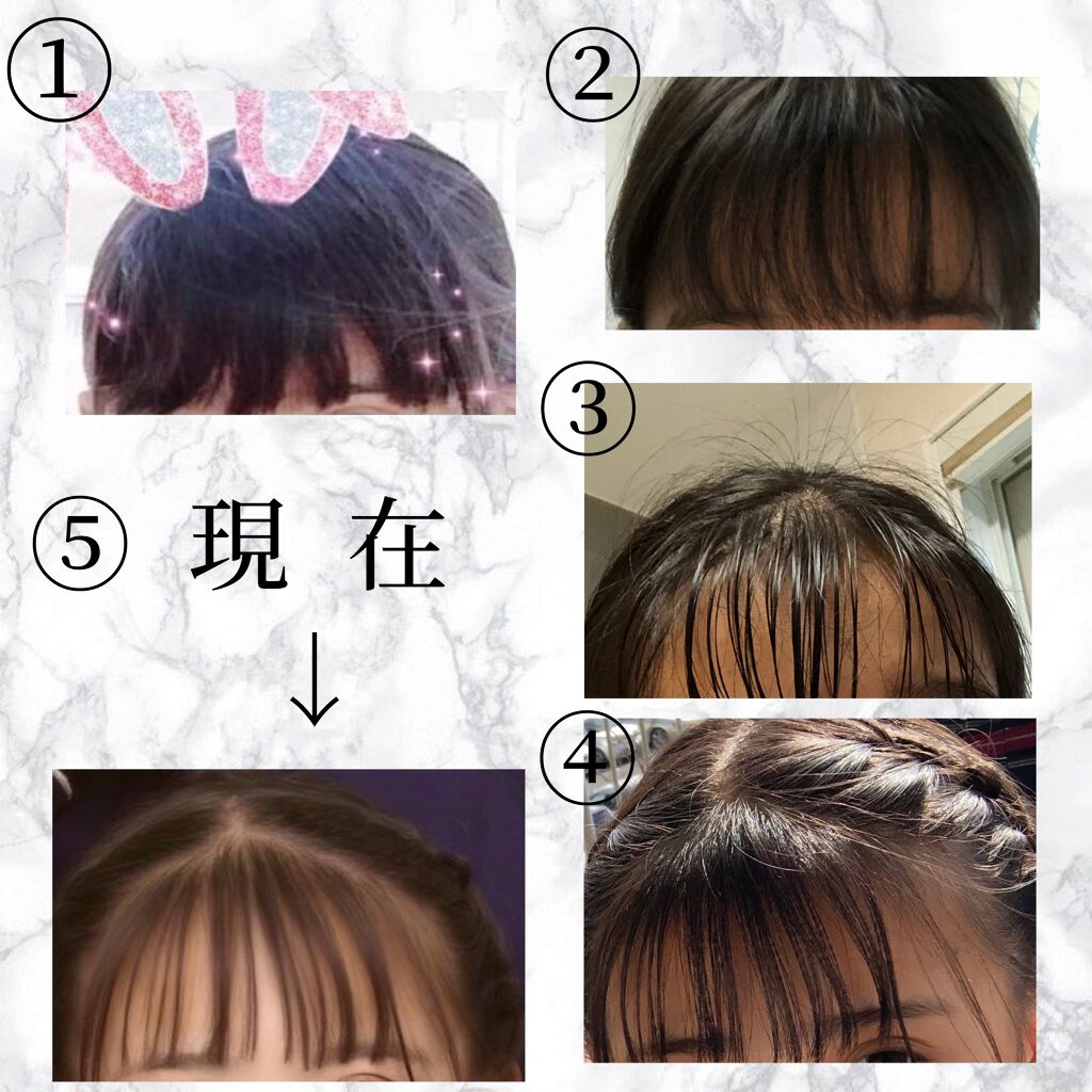 ハトムギ化粧水(ナチュリエ スキンコンディショナー R )/ナチュリエ/化粧水を使ったクチコミ（2枚目）