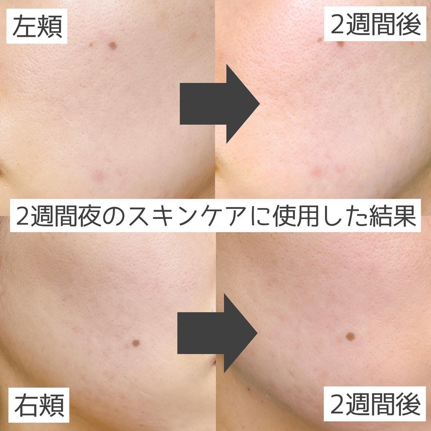 CICA デイリースージングマスク/VT/シートマスク・パックを使ったクチコミ(5枚目)