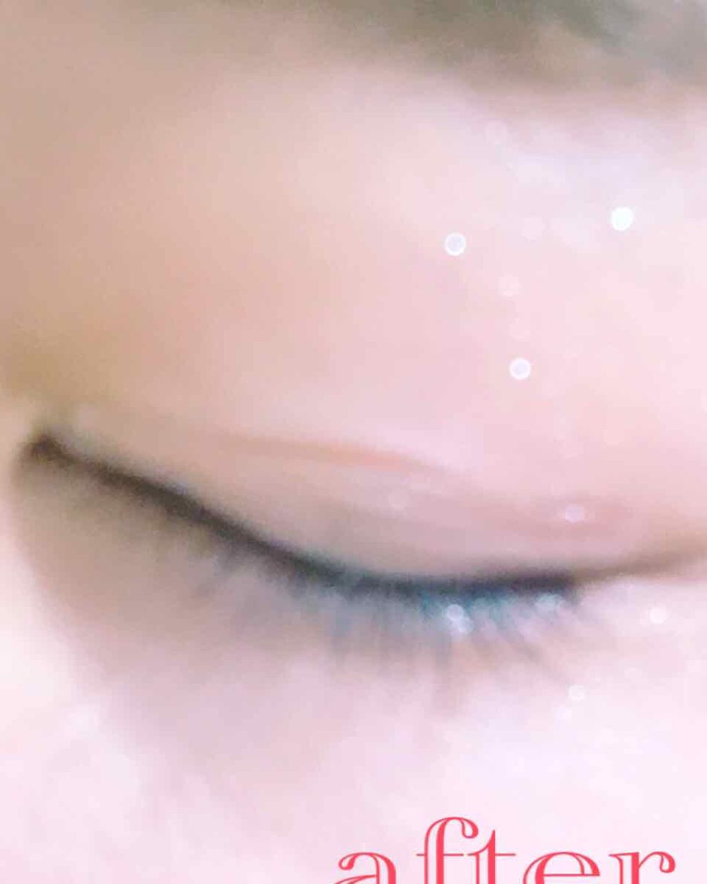 ハイブリッドフィルム/アイトーク/二重まぶた用アイテムを使ったクチコミ(3枚目)