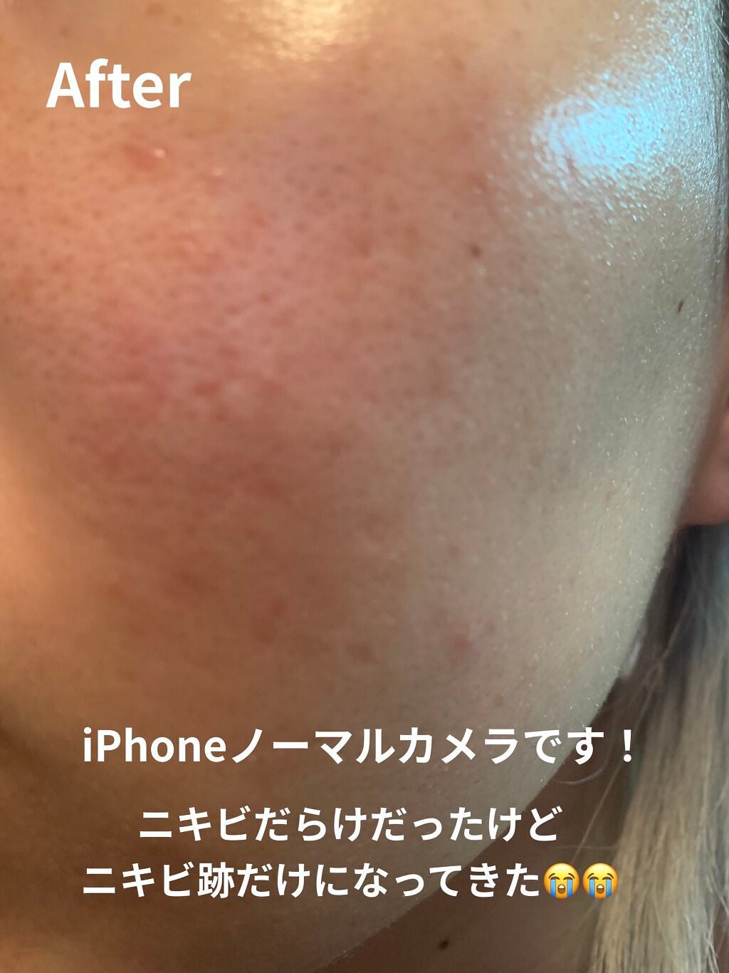 リアルカロテンブレミッシュクリアセラム/APRILSKIN/美容液を使ったクチコミ(3枚目)