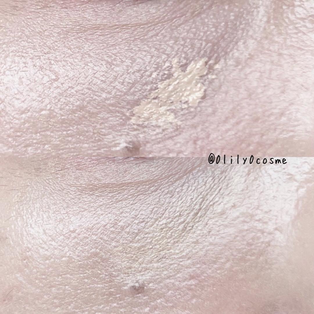 ダーマシンコンシーラー/23years old/リキッドコンシーラーを使ったクチコミ(5枚目)