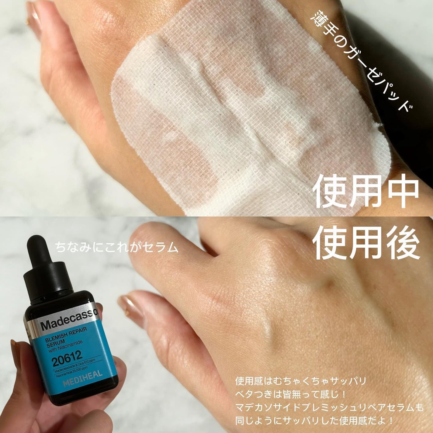 マデカソサイド ブレミッシュパッド/MEDIHEAL/トナーパッドを使ったクチコミ(5枚目)