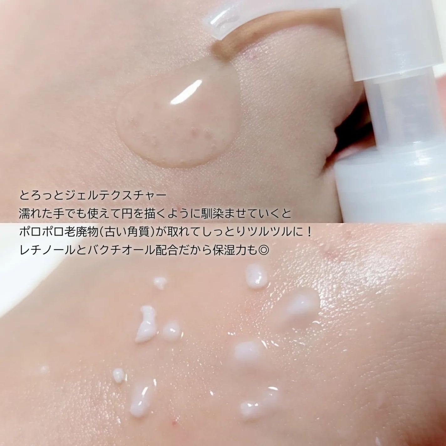 DETクリア ブライト&ピール ピーリングジェリー〈エイジングケアタイプ〉/Detclear/ピーリングを使ったクチコミ(2枚目)