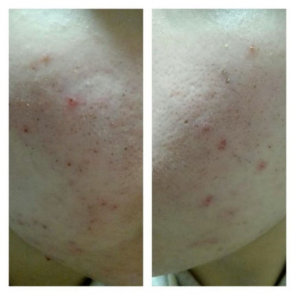 オールインワン美容乳液/うる肌うるり/オールインワン化粧品を使ったクチコミ(4枚目)