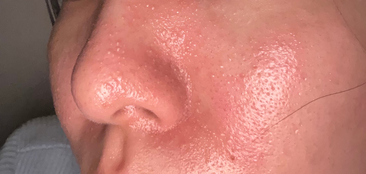 V エッセンス/unlabel/美容液を使ったクチコミ(4枚目)