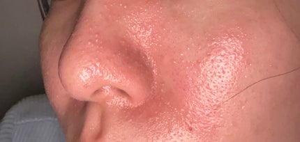 V エッセンス/unlabel/美容液を使ったクチコミ(4枚目)