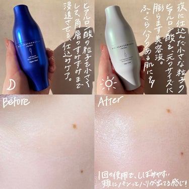 ビオパフォーマンス スキンフィラー 本体 各30mL/SHISEIDO/美容液の画像