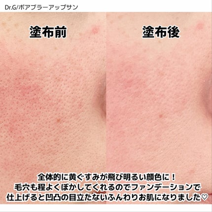 ポアブラーアップサン/Dr.G/日焼け止めクリームを使ったクチコミ(4枚目)