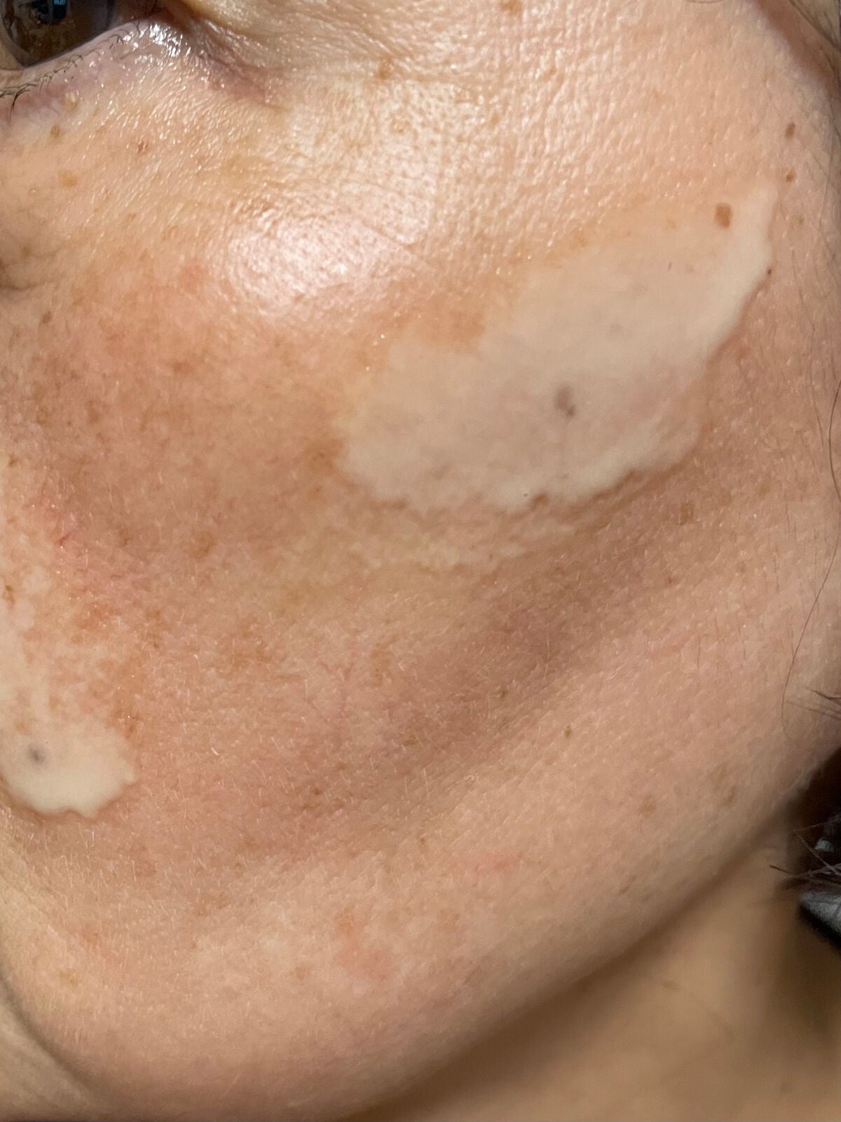 レディブラン 薬用美白ピールホワイト/シーヴァ/洗い流すパック・マスクを使ったクチコミ(1枚目)