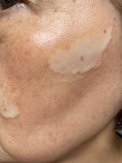 レディブラン 薬用美白ピールホワイト/シーヴァ/洗い流すパック・マスクを使ったクチコミ(1枚目)