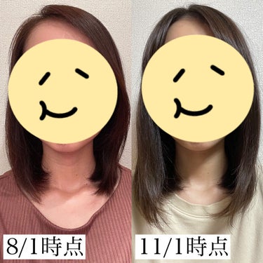 M子 on LIPS 「..ロングヘア大作戦の経過報告です！加美乃素本舗ヘアアクセルレ..」（2枚目）