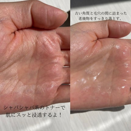 バリアサイクルトナー/P.CALM/化粧水を使ったクチコミ(2枚目)