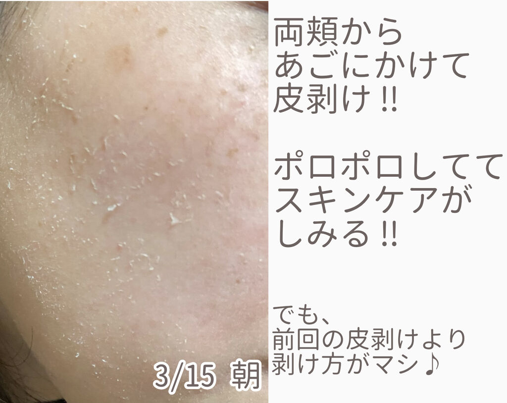 を使ったクチコミ（3枚目）